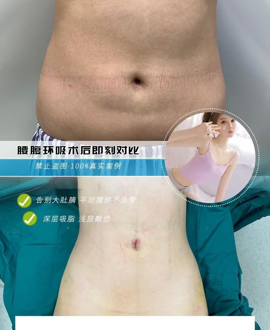 上海知名吸脂大咖都有哪些？2026年上海吸脂最好的专家预约排行榜大全