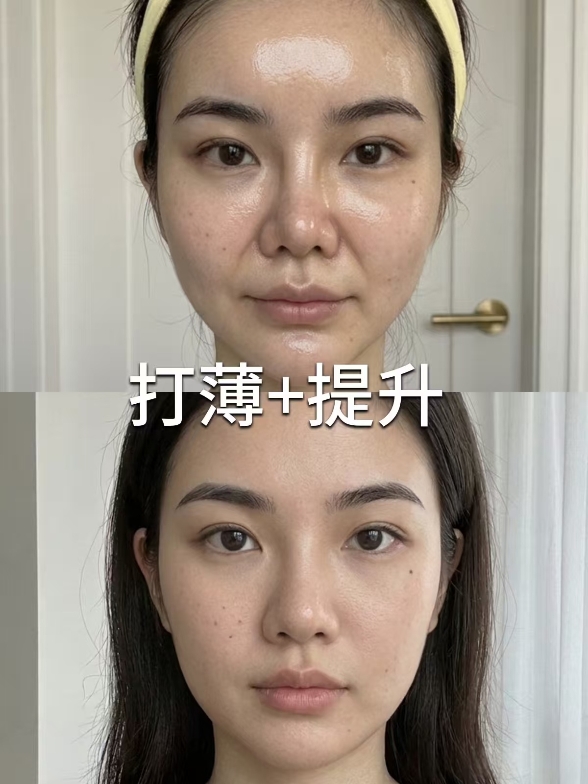 上海馒化修复医生吴贞跃、郭健、李东、张本军、杨胤恒谁做馒化修复最好？