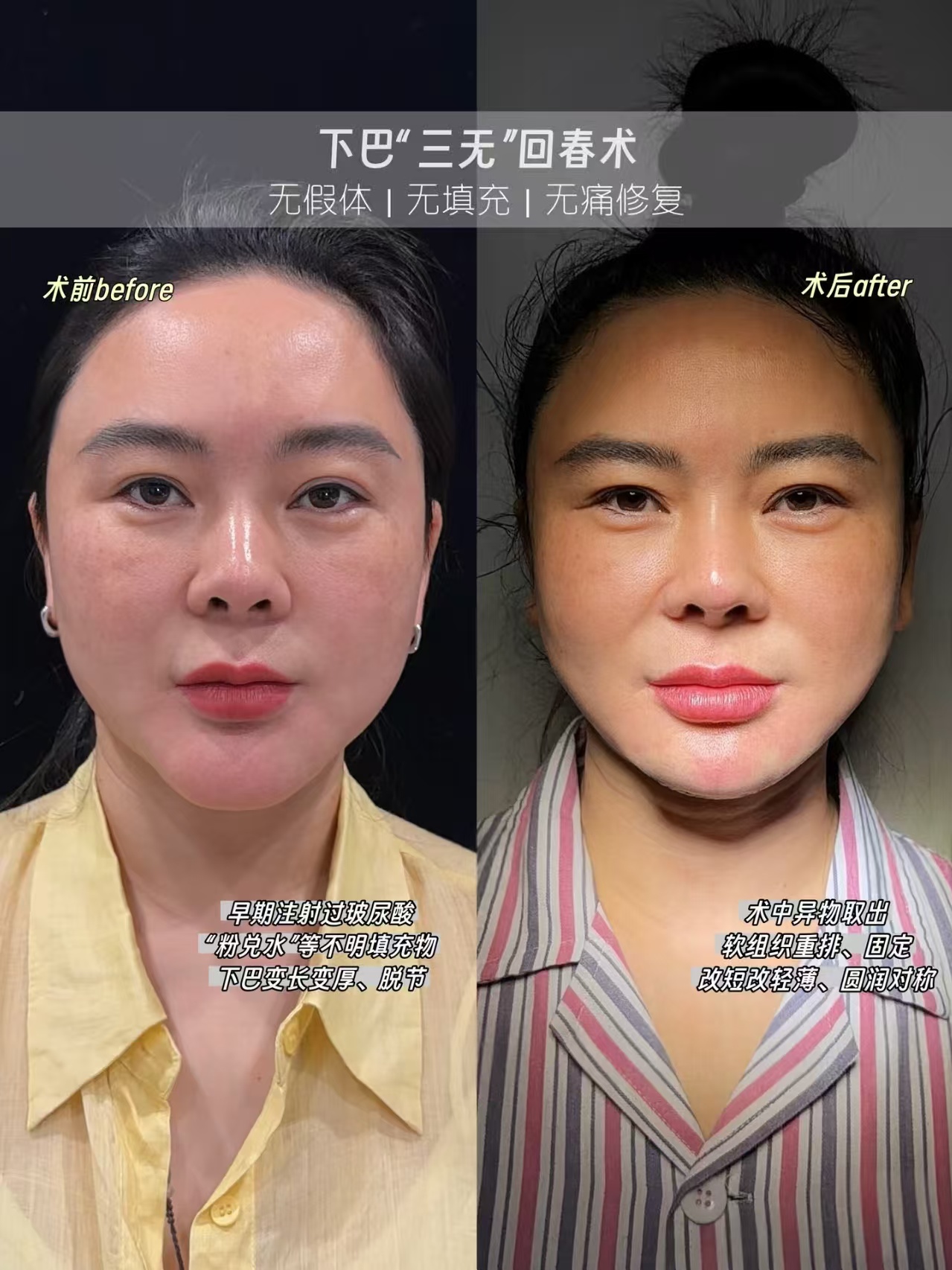 2026年取生长因子、奥美定、不明注射物谁最好？周云超、齐云香、朱慧东、郭鑫、李方奇、黎星、张立彬、丁小邦、王绍国、李东