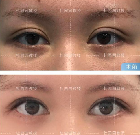2026年上海知名的眼修复专家有哪些？张楚、李勇、郑小红、杜园园、张诗若、李月辉？
