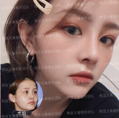 长沙市做鼻子做的最好的医生