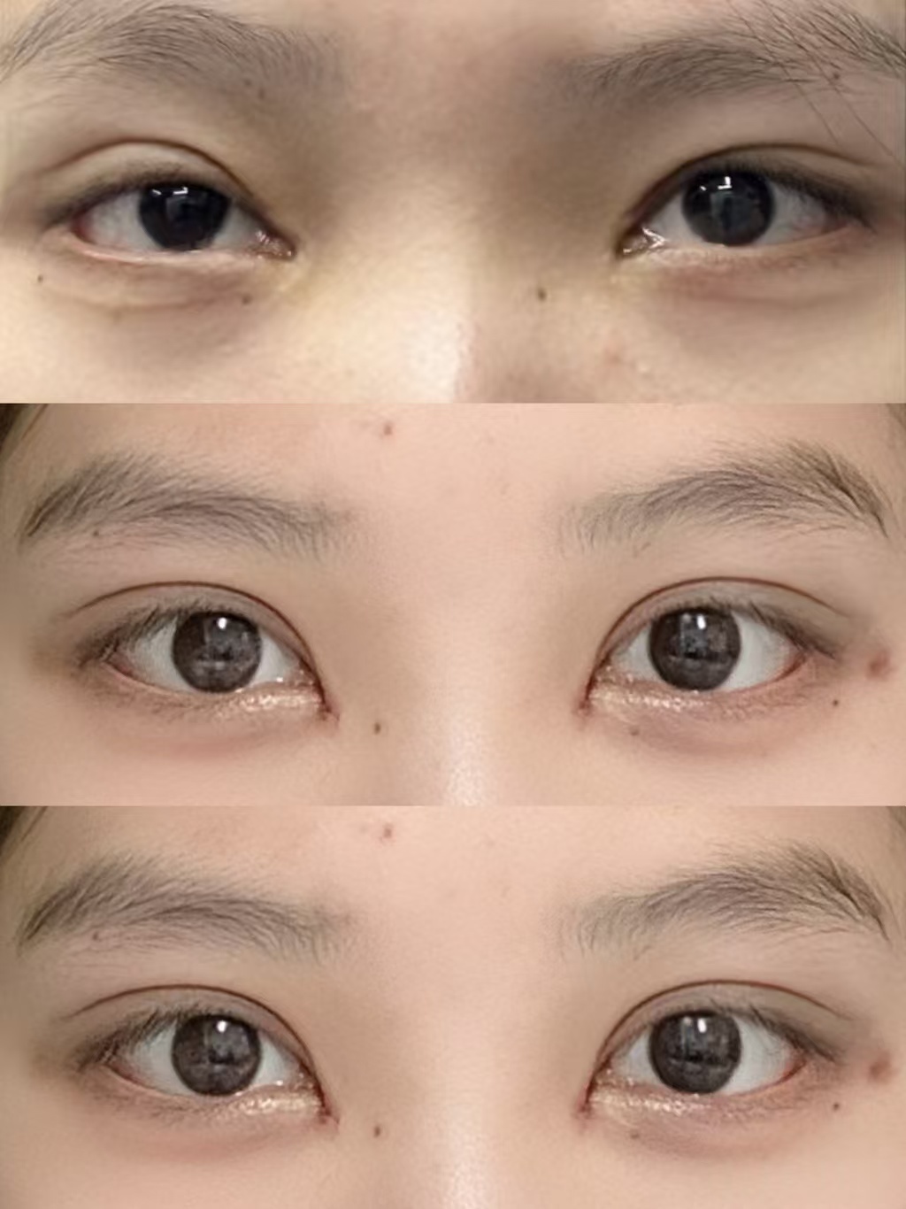 上海双眼皮修复医生预约排行榜大全：佀同帅、刘平、卢玲、马娟、郑小红眼修复谁最好？