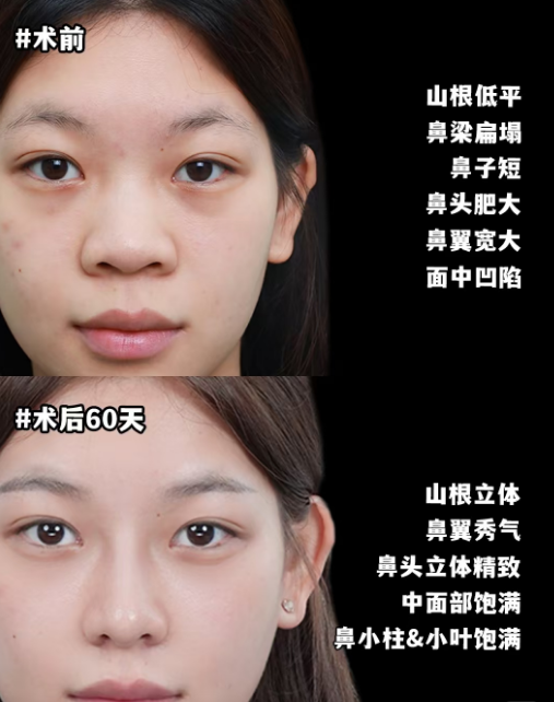 2026年上海鼻修复做的最好的医生是哪个？戴传昌、范荣杰、徐丽娟、王琳、李章、范锴、张勍枫？